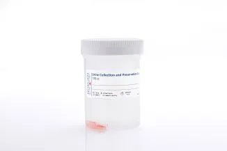 Norgen Biotek Urine Collection and Preservation Cup